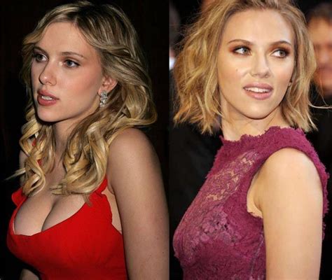 scarlette johansson boobs|Scarlett Johansson Plastic Surgery: Before & After ...